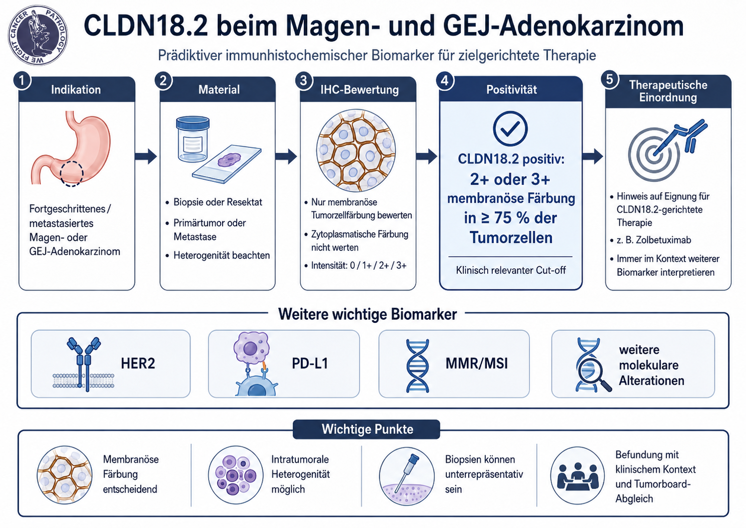 CLDN18.2 beim Magen- und GEJ-Adenokarzinom: neuer prädiktiver IHC-Marker für zielgerichtete Therapie